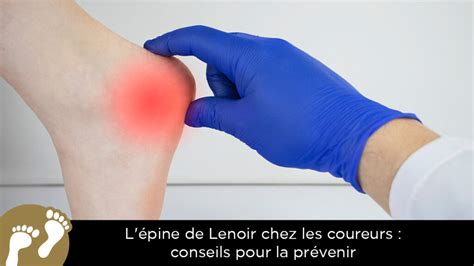 L'épine de Lenoir chez les coureurs : conseils pour la prévenir - Pied Confort