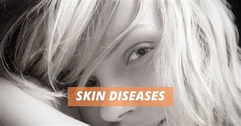 Skin Diseases : Prevention of Skin Diseases