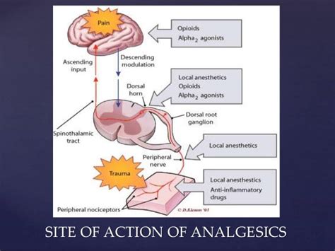 Preemptive analgesia