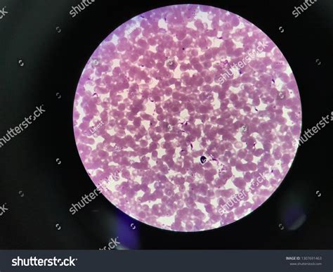 Trypanosoma Gambiense Trypomastigote Stage Light Microscope Stock Photo ...