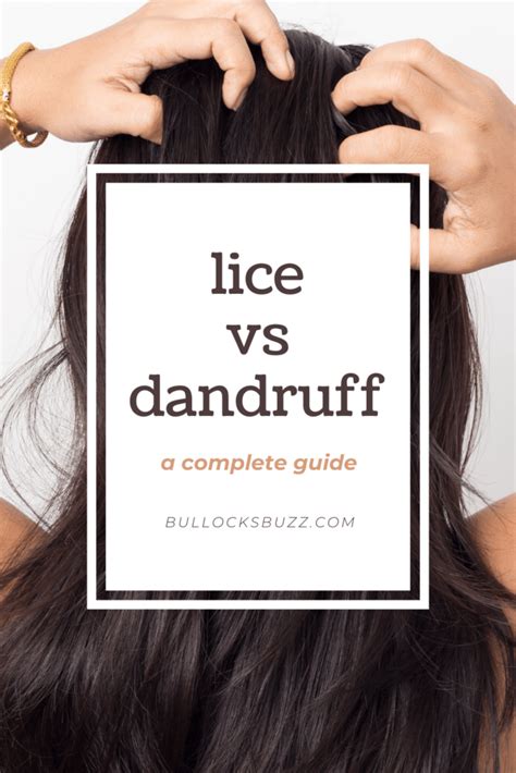 Lice vs. Dandruff - A Complete Guide - Bullock's Buzz