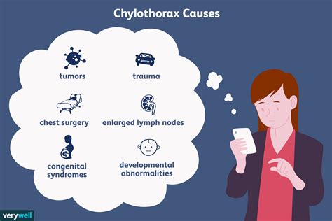 Chylothorax: Definition, Symptoms, Diagnosis, Treatment