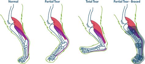 Achilles Tendon Ruptures in Dogs and Bracing - PawOpedic™