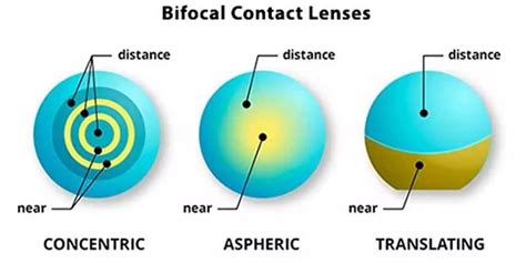 What are Bifocal Contact Lenses? - Metro Brazil Blog