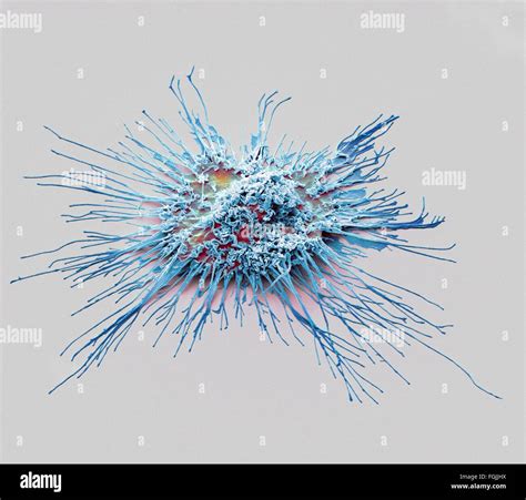 Dendritic Cell Electron Microscope