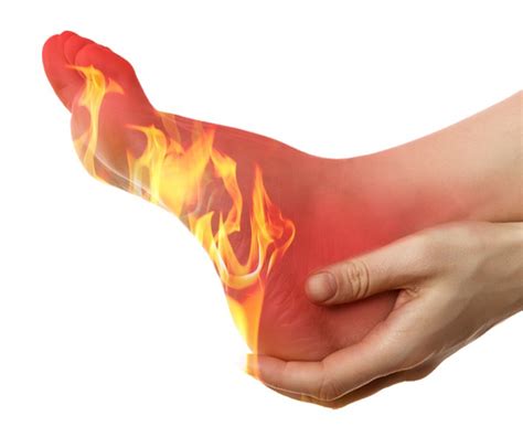 I have a burning sensation on my feet. Why are my feet on fire ...