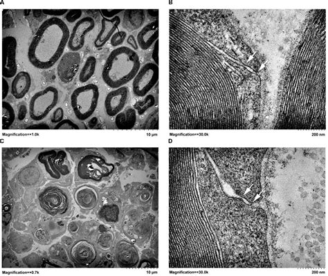 Frontiers | Peripheral Nerve Injury Induces Dynamic Changes of Tight ...