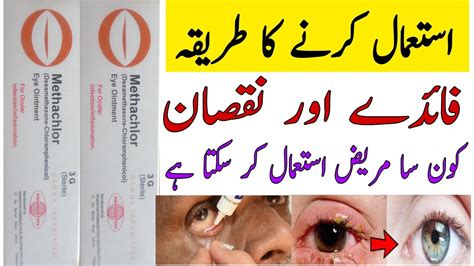 Methachlor eye ointment use's benefit and said affect ||Methachlor eye ointment use's in Urdu ...