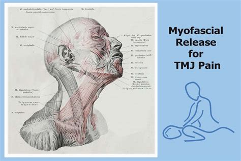 Myofascial Pain Syndrome What Are The Causes Pmir