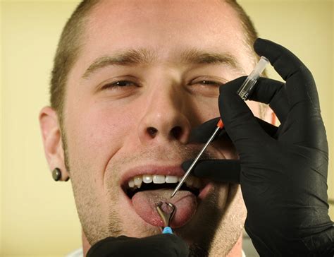 What does your dentist think about tongue piercing?