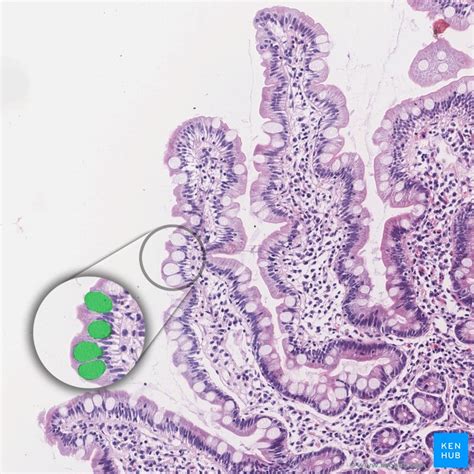 Lower digestive tract: Histology | Kenhub