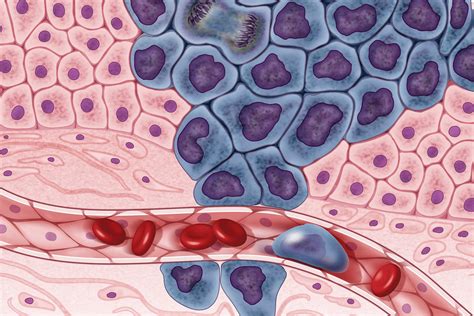 Cancer cells illustration | In this image: Growing cancer ce… | Flickr