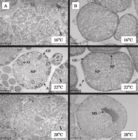 Gonad histology. (A) Histological cross-sections of female acini from... | Download Scientific ...