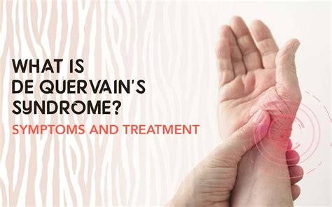 De Quervain's Syndrome - Symptoms & Treatment | CopperJoint