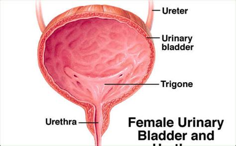 Carcinoma of the Urethra overview, Diagnosis and Staging, Differential ...