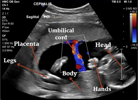 Color Doppler Test Pregnancy: Price, Purpose & Timing [2024]