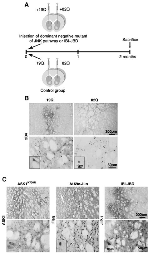 Expression of transgenes in vivo. (A) Experimental design in adult ...