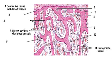 Trabeculae Of Bone