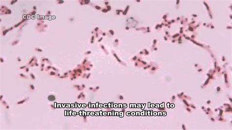 Fusobacterium & Infections - YouTube