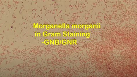 Gram Negative Rods of Morganella morganii in Gram Staining - YouTube