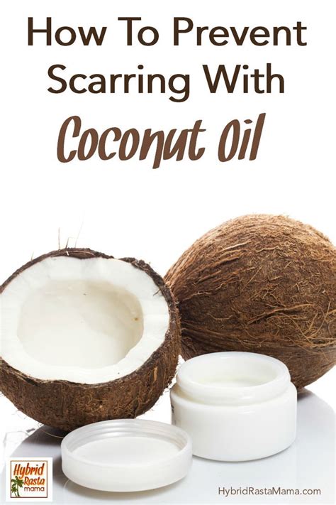 How To Prevent Scarring With Coconut Oil | Scar prevention, Coconut benefits, Coconut