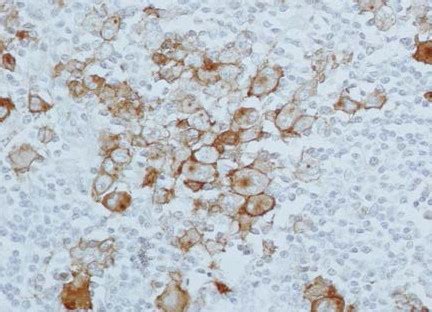 CD 30 | CD30 Stain Antibody | IHC | Sakura Finetek USA