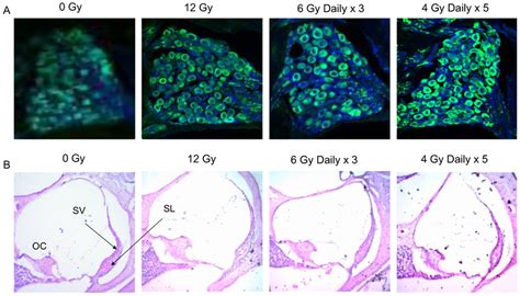 Immunohistochemistry of Spiral Ganglion Cell Bodies and Histology of ...