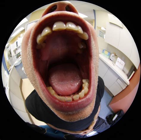 What Does Your Uvula Do? | Wonderopolis