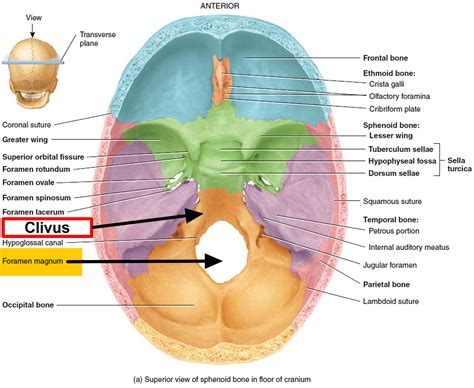 Chiari Malformation - Causes, Symptoms, Prognosis, Diagnosis, Treatment