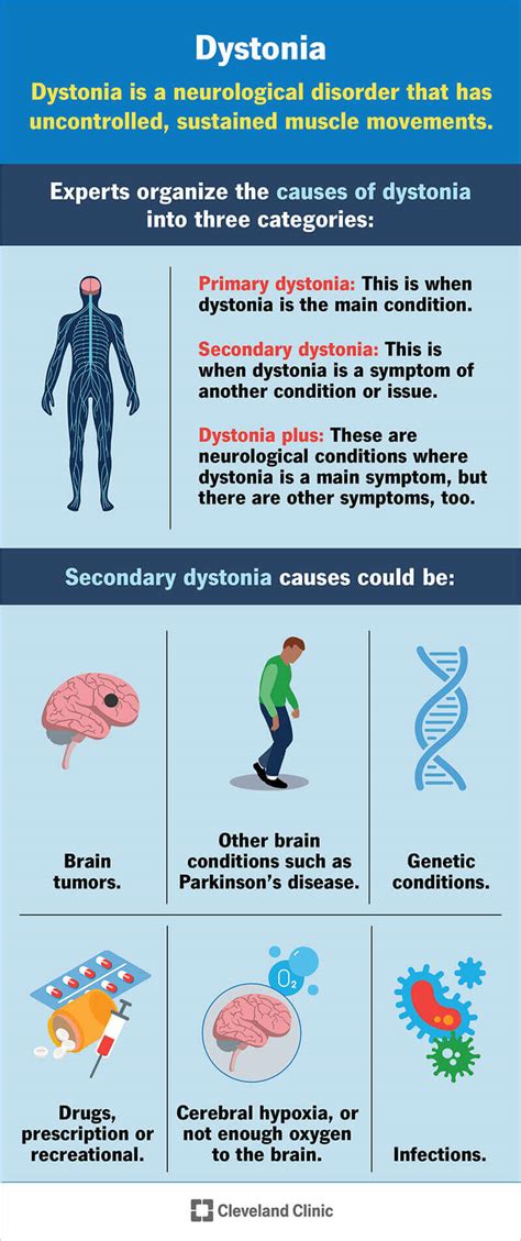 Dystonia: What It Is, Causes, Symptoms, Treatment & Types