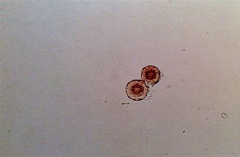 Leucine Crystals