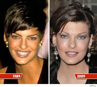 Celebrity Plastic Surgery: Linda Evangelista Plastic Surgery Before and ...