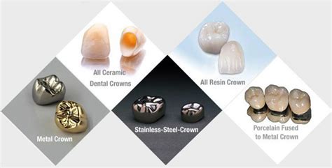 Dental Crowns and Caps in Hyderabad | Dental Crowns in Hyderabad