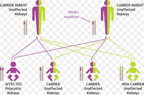 Autosomal Recessive Polycystic Kidney Disease Genetic Testing Autosomal Dominant Polycystic ...