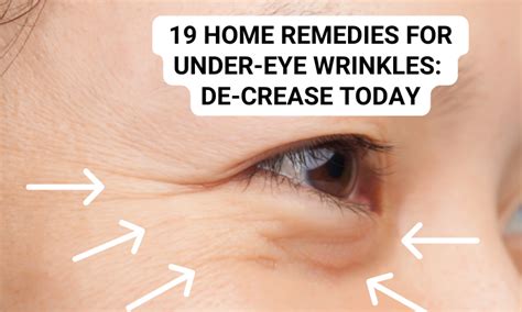 19 Home Remedies For Under-Eye Wrinkles: De-Crease Today - Skin Beauty