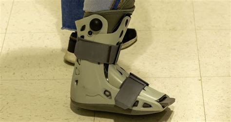 What You Need to Know About Ankle Replacement Surgery