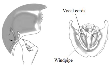 Draw a labelled diagram of larynx and explain its functions