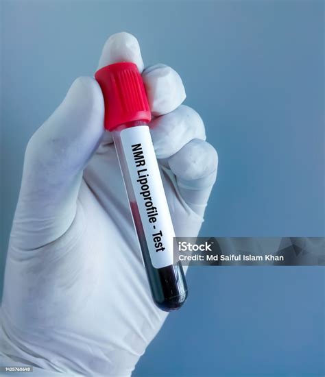 Blood Sample For Nmr Lipoprofile Test Stock Photo - Download Image Now - Analyzing, Bangladesh ...