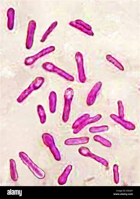 Clostridium botulinum Stock Photo: 69119147 - Alamy