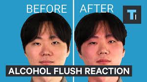 Alcohol Flush Reaction - Public Health