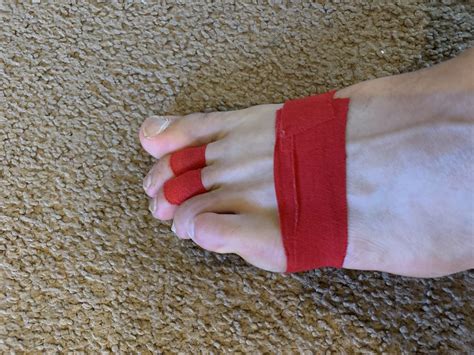 How To Tape Toes for Plantar Plate Tear - Plantar Health