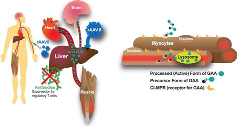 Pompe Disease Gene Therapy - Captions Pages