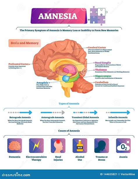 Neuropsicología de la memoria