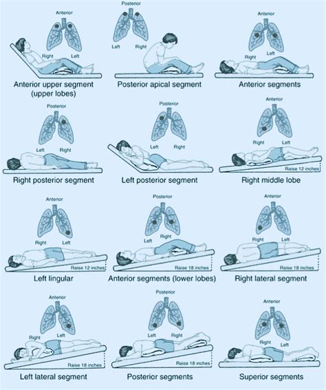 For preparedness, I've been studying general respiratory health ...