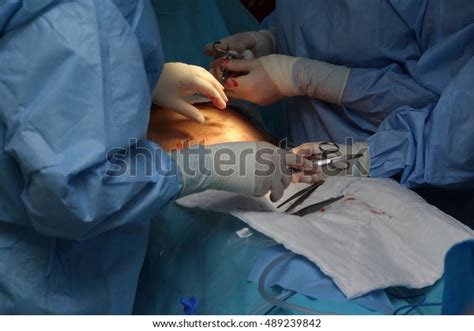 Cesarean Surgery Birth Stock Photo 489239842 | Shutterstock