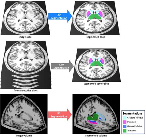 Segmentation Of 3D MRI Using 2D Convolutional Neural, 49% OFF