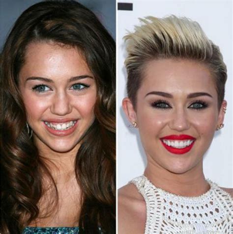 Celebrities with Veneers