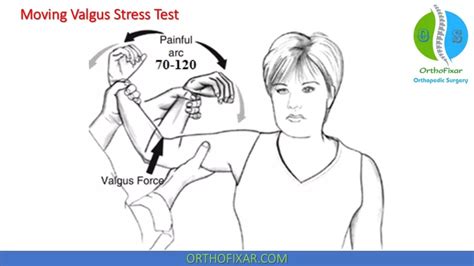 Moving Valgus Stress Test | OrthoFixar 2024