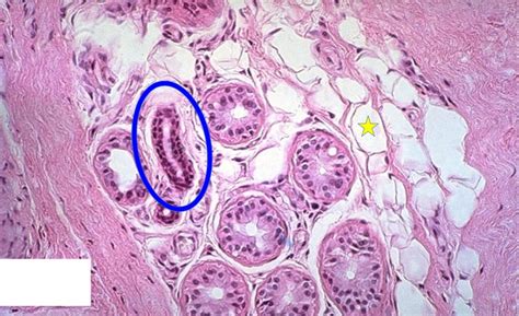 Sweat Glands 1 (Eccrine) Diagram | Quizlet