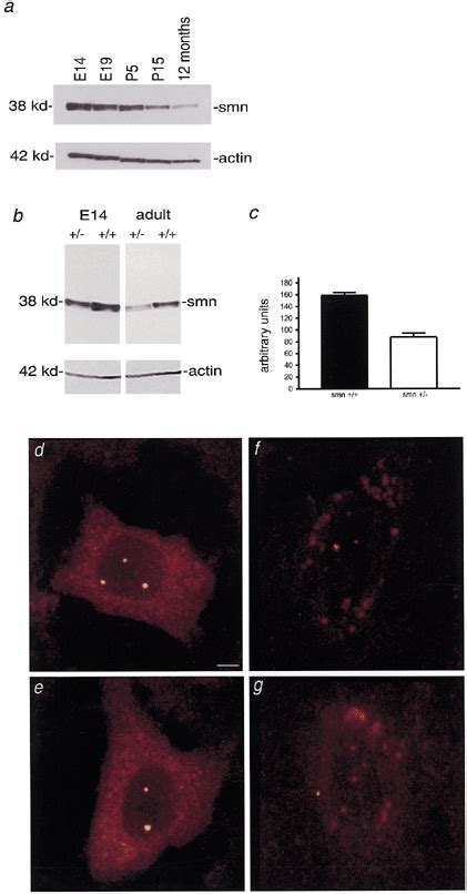 Smn protein levels in the spinal cord and subcellular distribution in ...